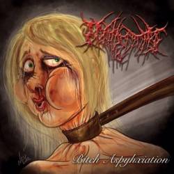 Nephrectomy : Bitch Asphyxiation